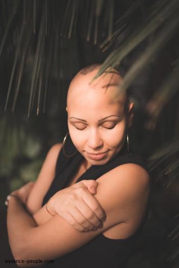 Ieva Putnina opening up about hair loss and Alopecia in public, 2019.