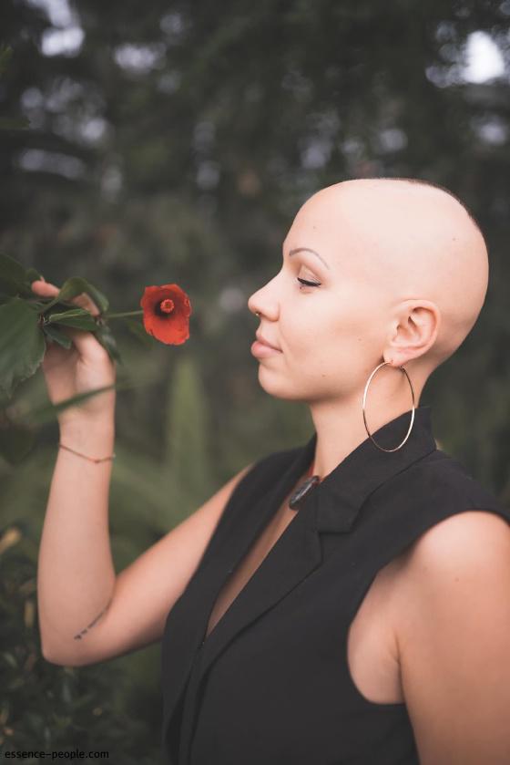 "Alopecia Doesn’t Kill the Person, but It Kills the Self-Confidence". A Hair-Loss Story by Ieva Putnina.